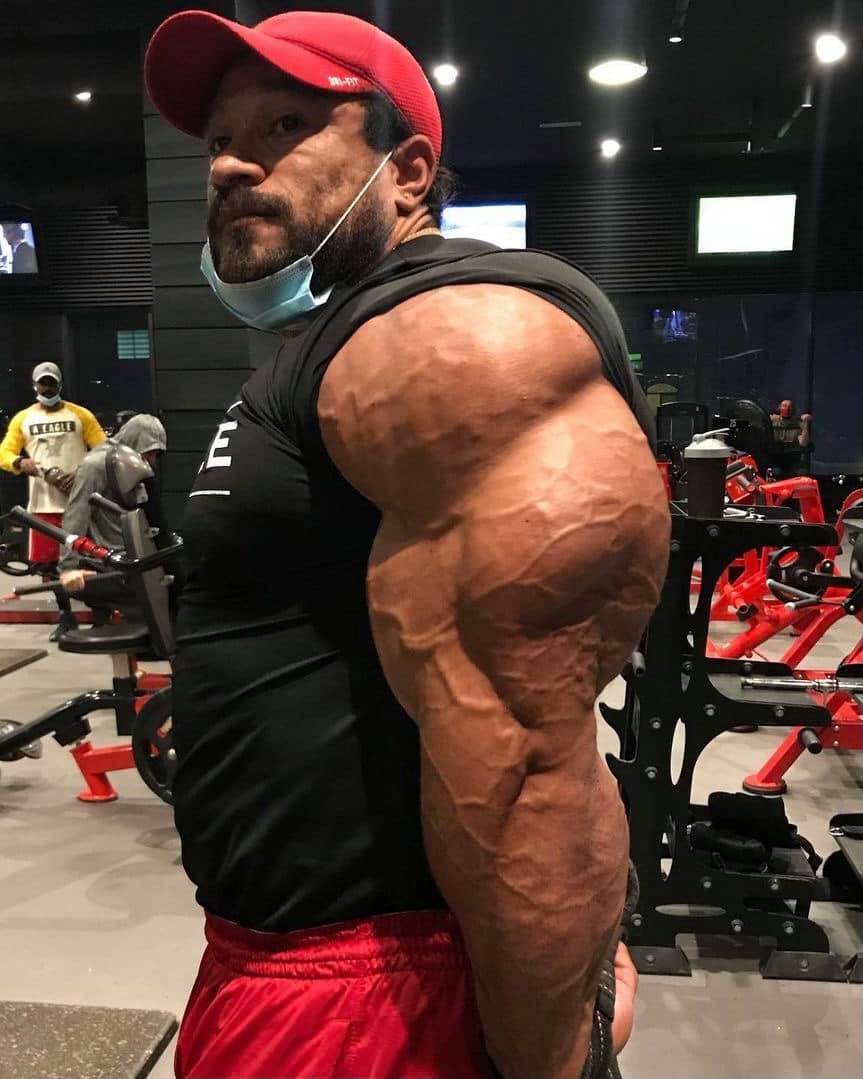 Triceps